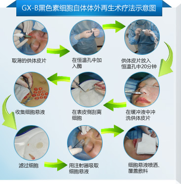 南宁白癜风专科医院