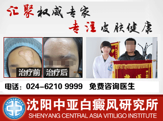 南宁白癜风专科医院