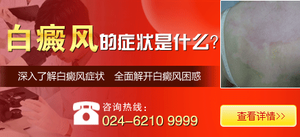 南宁西京白癜风医院