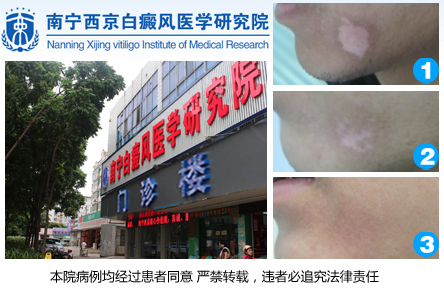 南宁西京白癜风医院.jpg