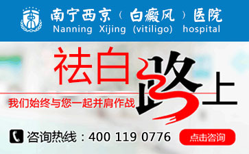 °×ñ°·ç¸´·¢Ìõ¼þÓÐÄÄЩ