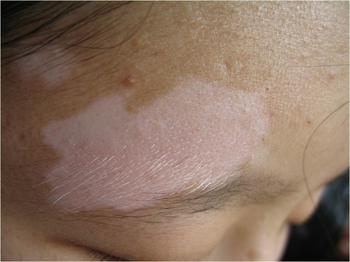 °×ñ°·çµÄ¾ßÌåÒòËØÓÐÄÄЩ