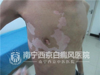 杜威(化名),男 ,36岁