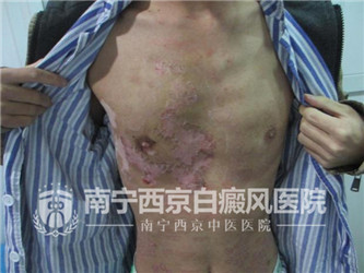 杜威(化名),男 ,36岁