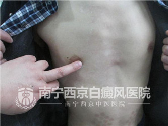 杜威(化名),男 ,36岁