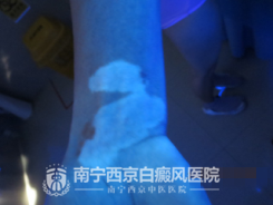 郭女士 ,女, 32岁