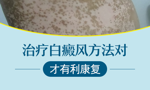 °×ñ°·ç²»ºÃÖÎ