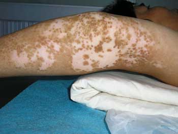 °×ñ°·ç»á²»»á´«È¾ÈË