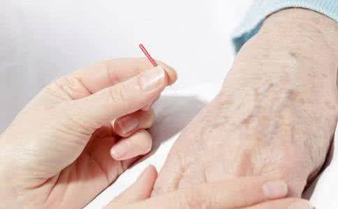 为什么白癜风会发作