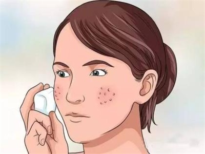 面部白癜风要注意什么
