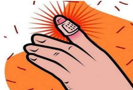 如何治疗外伤引起的皮肤白斑