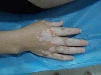 ÊÖ²¿ÎªÊ²Ã´Óа×ñ°·ç