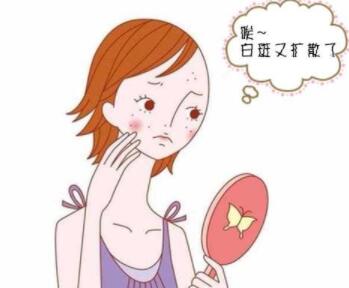 女性得了白癜风之后化妆怎么办?